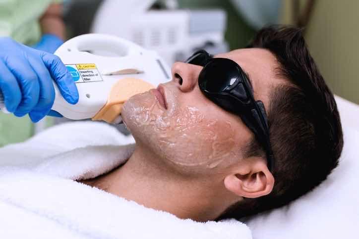 ជម្រុះពុកមាត់បុរស Laser