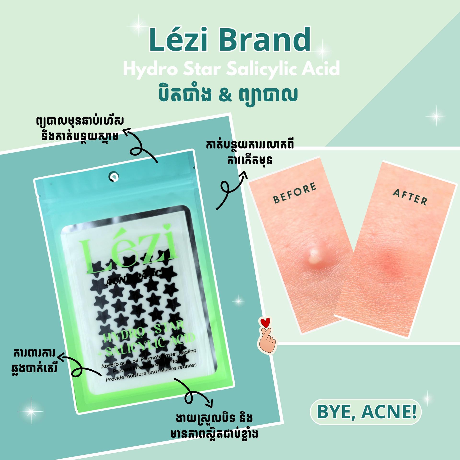 Lรฉzi Pimple Patches