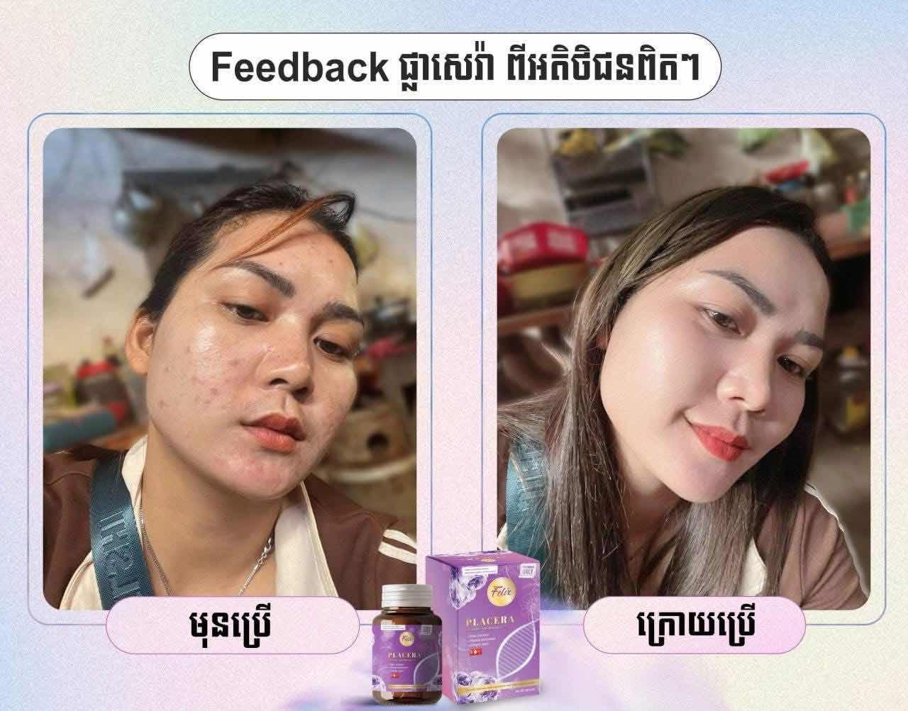 Felix Collagen ពណ៌ស្វាយ