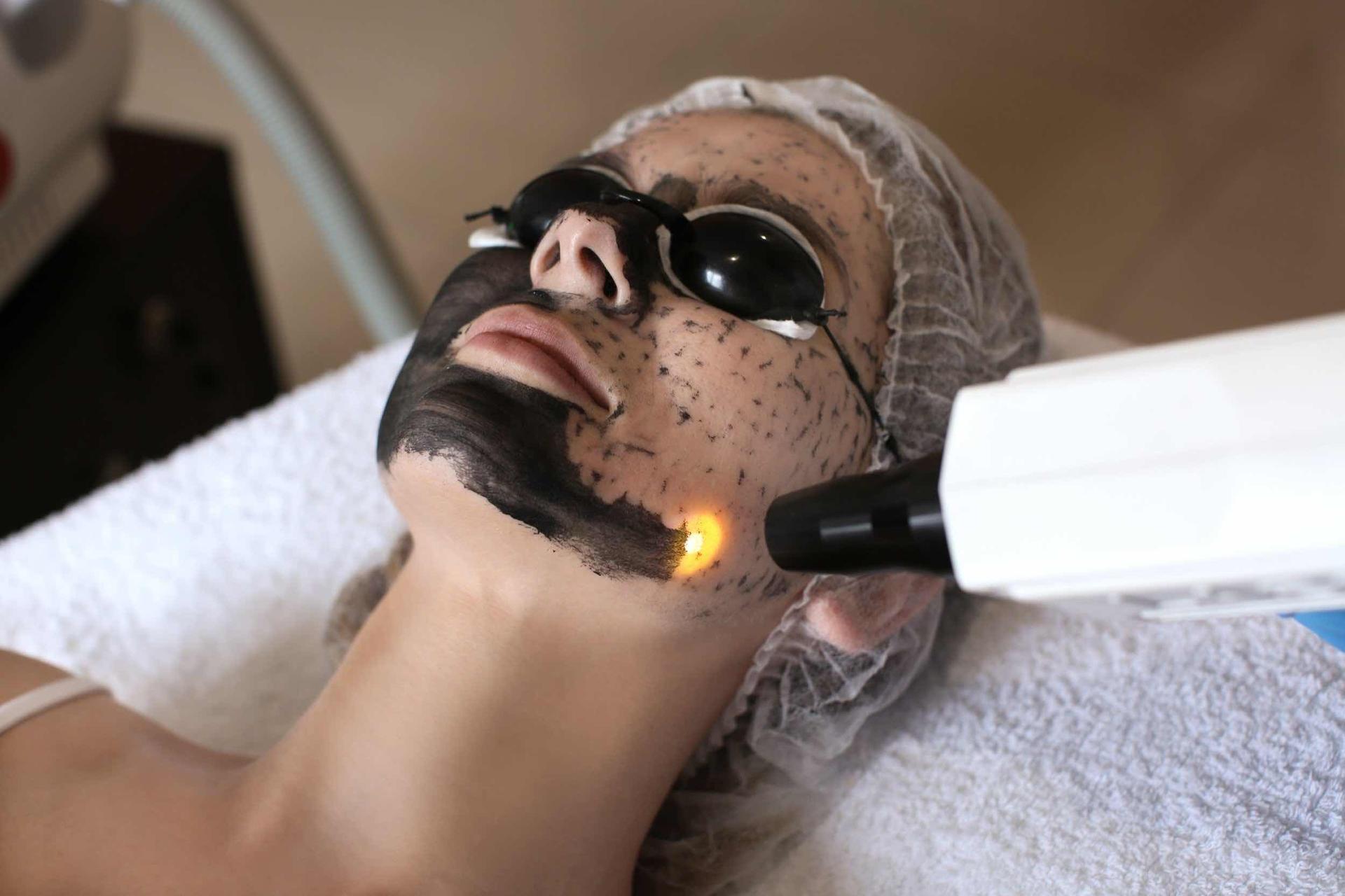 បាញ់កាបោនផ្ចិតរុនញីស Laser