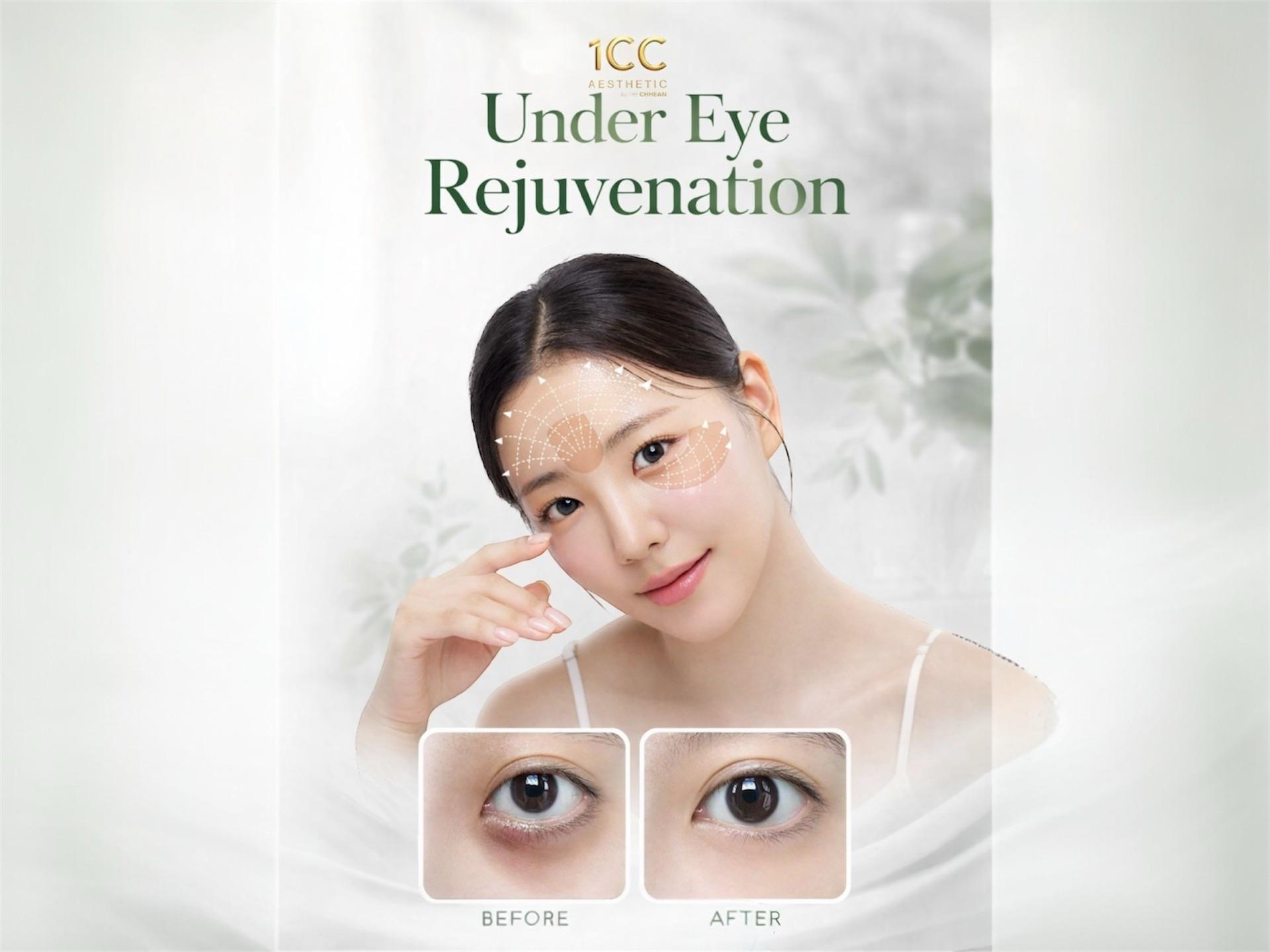 Eye Rejuvenation Careបាត់ស្លក់ ដក់ក្រោមភ្នែក