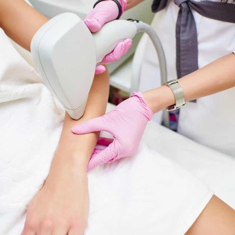 ជម្រុះរោមដៃ Laser