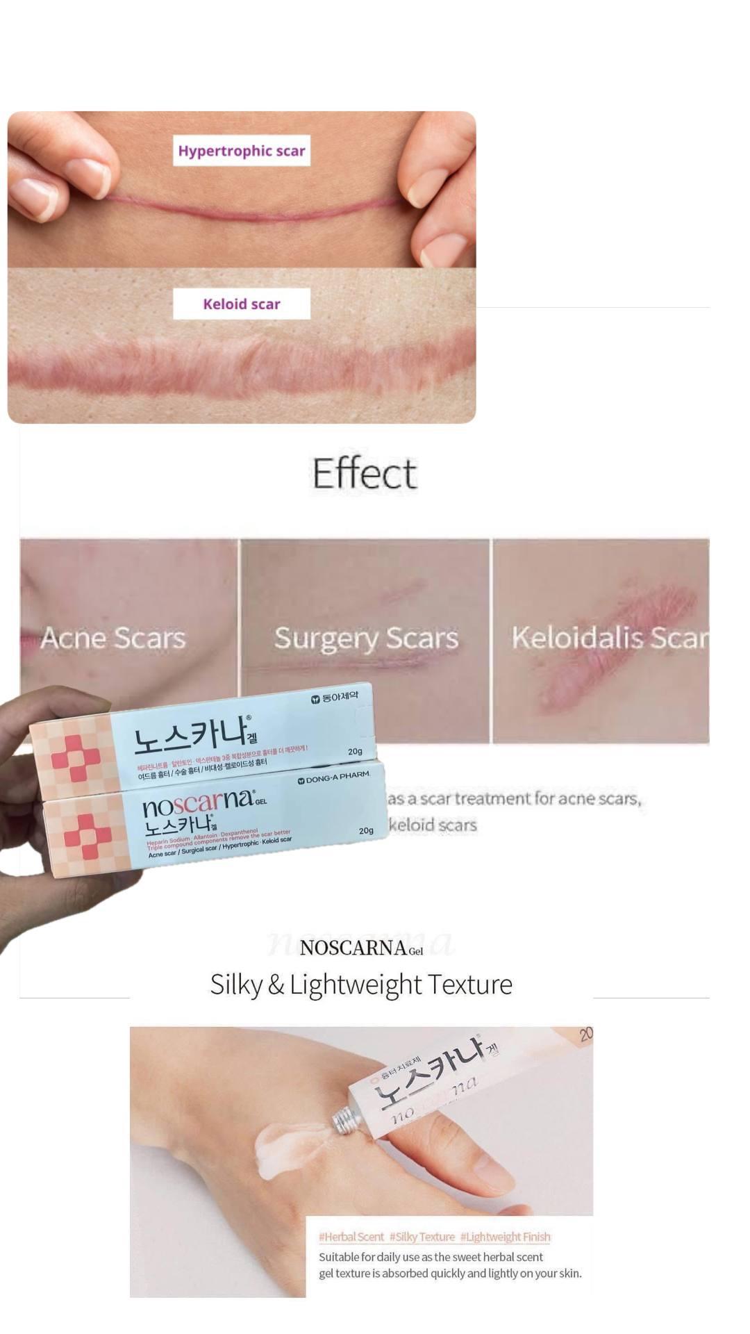 Dong-A Noscarna Gel 20g