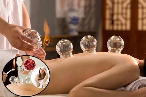 Cupping Therapy