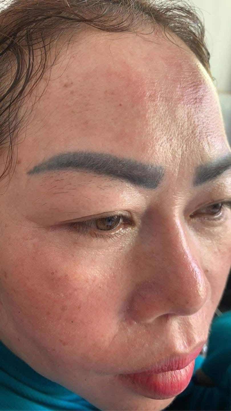 កែរចញ្ចើមពណ៌ខ្មៅបែកខៀវ Laser