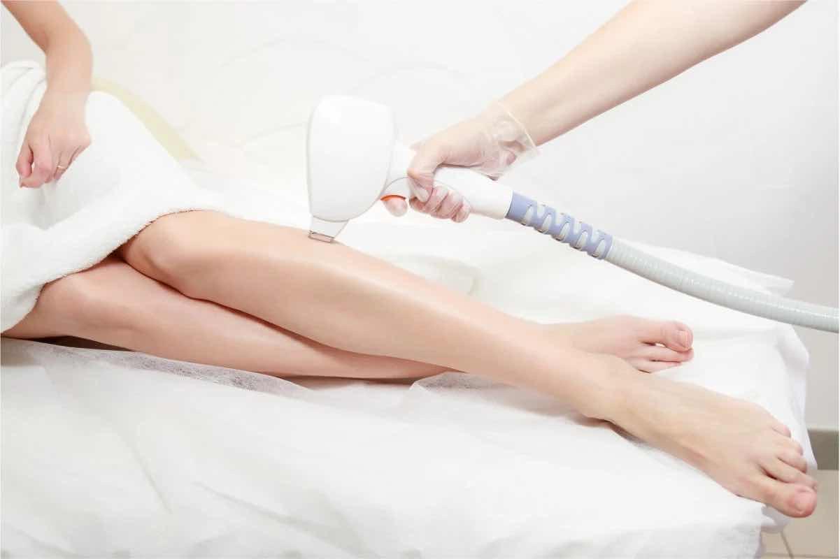 ជម្រុះរោមជើង Laser